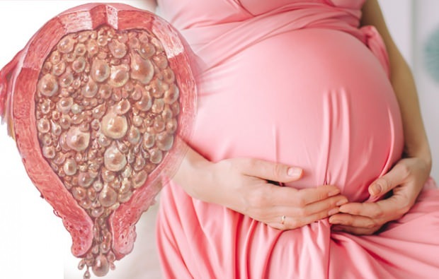 Что такое виноградная беременность, симптомы виноградной беременности