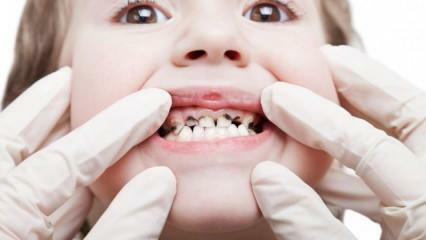 Позаботьтесь о зубах вашего ребенка в течение семестра!
