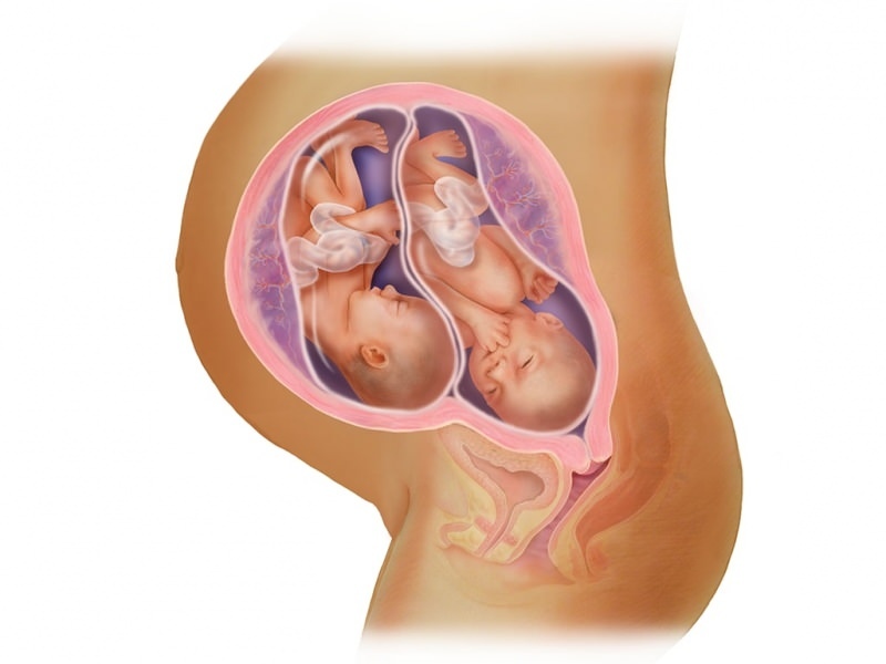 Двойная беременность в ЭКО! Что такое перенос эмбрионов?