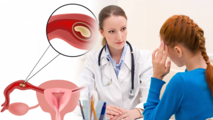 Что такое внематочная беременность (Ectobic беременности), почему? Каковы признаки внематочной беременности?