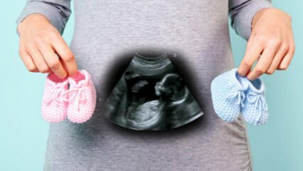 Будет ли определен пол малыша в первом триместре беременности?