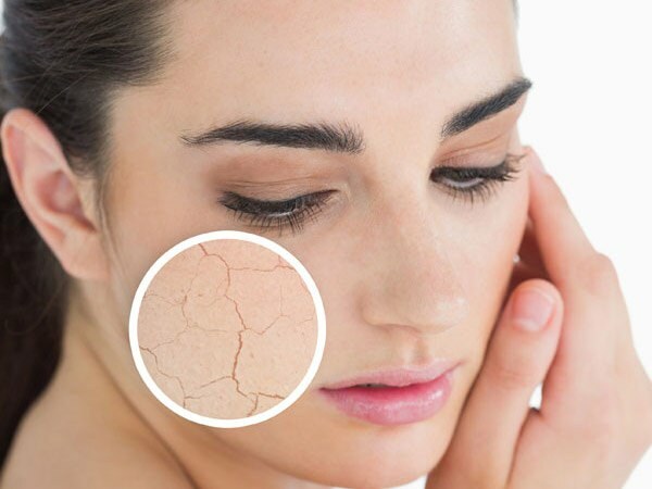 Почему кожа высыхает? Что делать на сухой коже? Самые эффективные рекомендации по уходу за сухой кожей