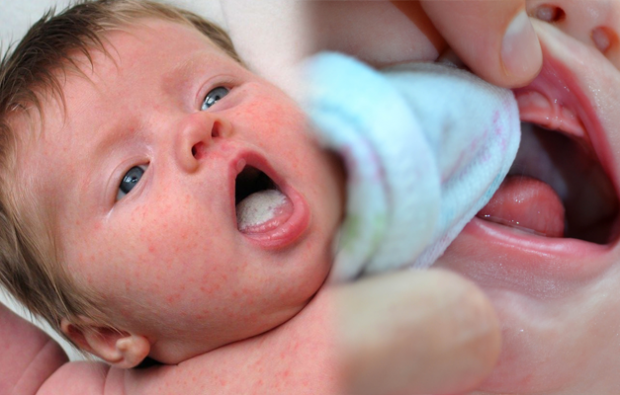 Как проходят язвочки во рту у малышей