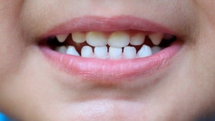 Как научить детей уходу за зубами?