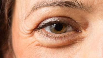 Как проходят мешки под глазами? 10 лучших кремов от мешков под глазами