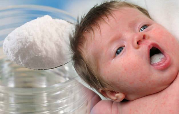 Подходит ли пищевая сода при молочнице?