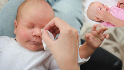 Как убрать заусенцы у младенцев? Причины появления заусенцев в глазах у младенцев? Массаж заусенцев с грудным молоком