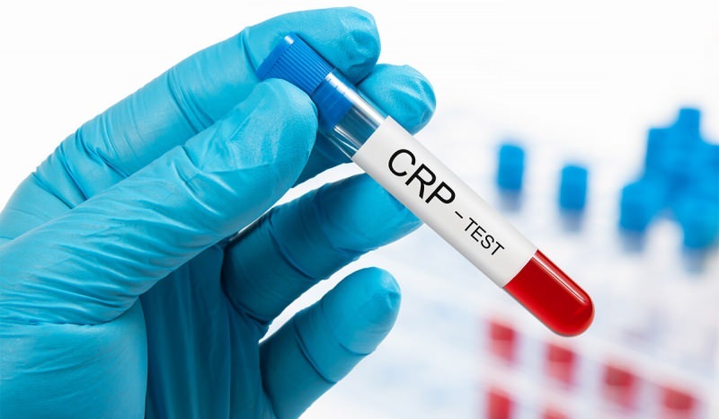 Почему повышается уровень СРБ в крови? Что такое CRP? Как снизить CRP?