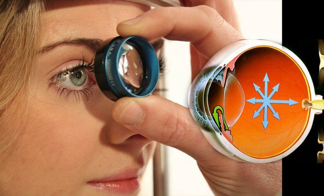 Что такое глаукома? Обратите внимание на это заболевание, которое коварно прогрессирует, не давая никаких симптомов!
