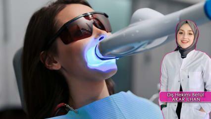 Как проводится метод отбеливания зубов (Bleaching)? Вредит ли метод отбеливания зубам?