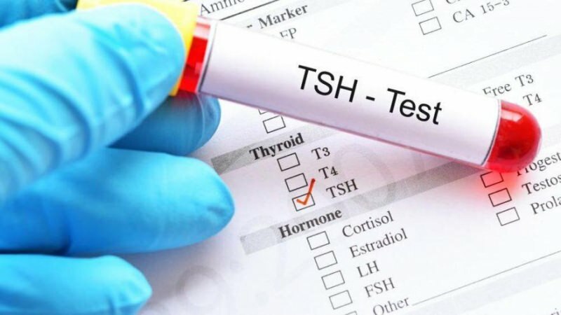 tsh-тест - это гормональный тест