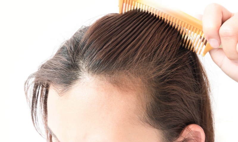 выпадение волос после родов! Что хорошо для выпадения волос?