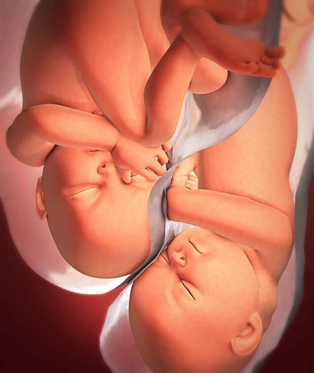 Каковы симптомы двойной беременности?
