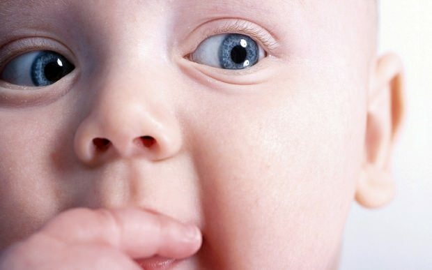 Почему у младенцев смещение глаз?