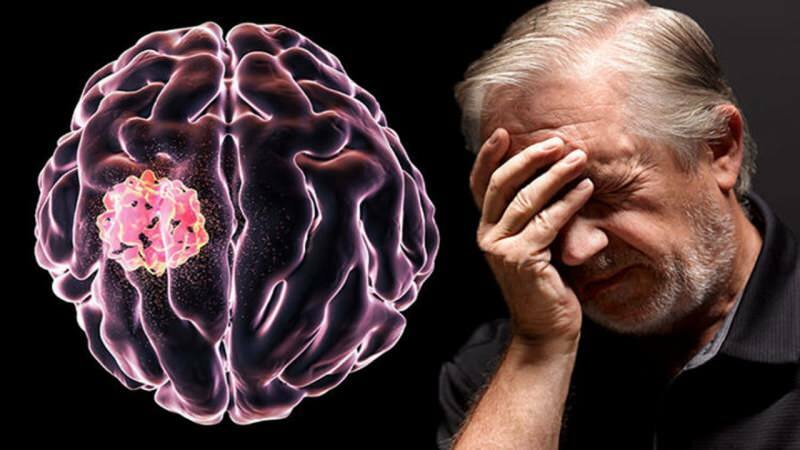 Ткань, образованная в головном мозге в результате разрушения клеточных структур, называется опухолью.