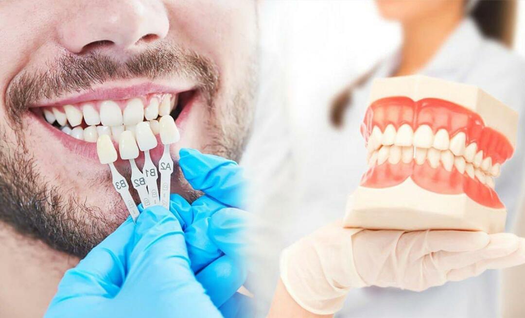 Почему на зубы накладывают циркониевые виниры? Насколько долговечно циркониевое покрытие?