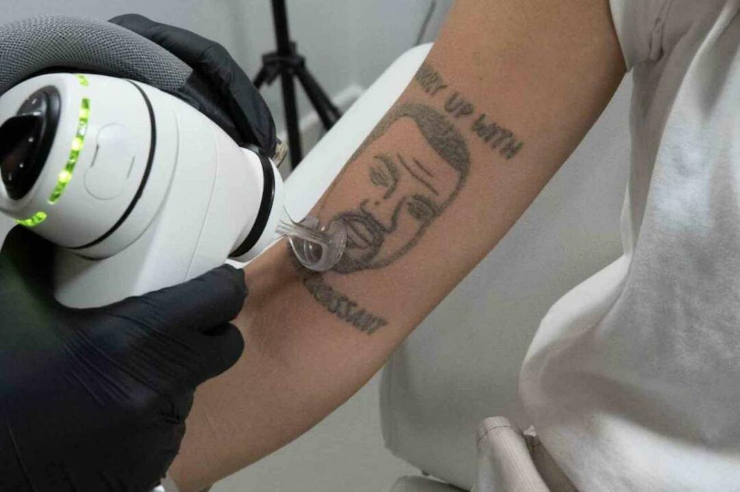 В Лондоне бесплатно удалят татуировку Канье Уэста 