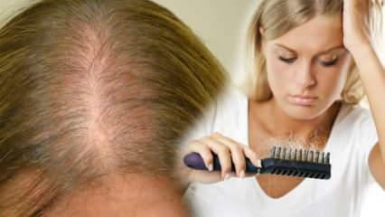Какой самый эффективный метод против выпадения волос? Рецепты масок, останавливающих выпадение волос