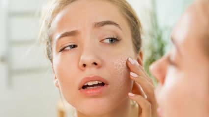 Почему кожа высыхает? Что делать на сухой коже? Самые эффективные рекомендации по уходу за сухой кожей
