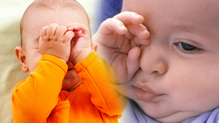Натуральные решения от жжения глаз у младенцев