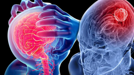 Что такое дегенерация мозжечка (спинного мозга)? Каковы симптомы мозжечка (спинного мозга)?