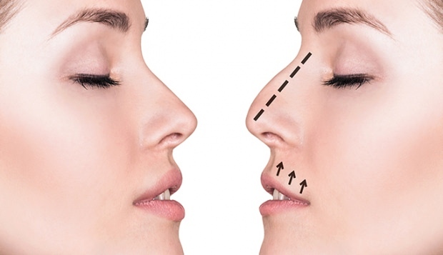 Что нужно учитывать в эстетике носа