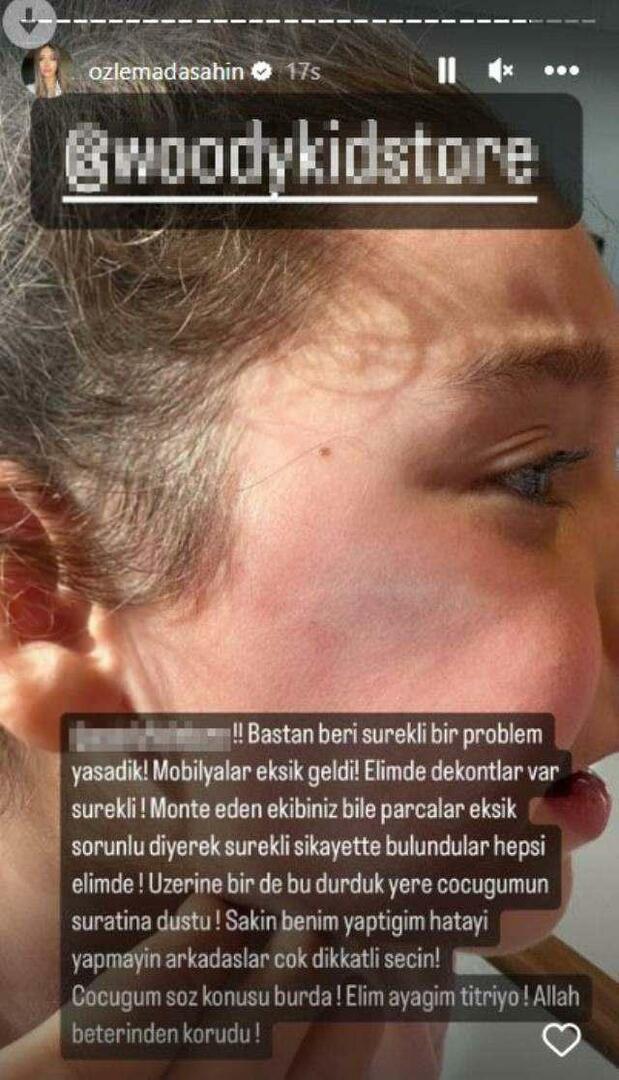 Дверь шкафа упала на лицо дочери Беркая Шахина