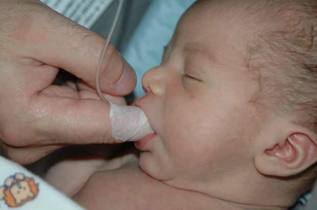Что такое метод кормления пальцами? Как кормить ребенка с помощью шприца?