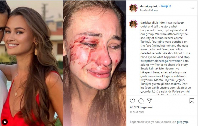 Модель Дарья Кирилюк, избитая в Измире Чешме, заразилась коронавирусом!