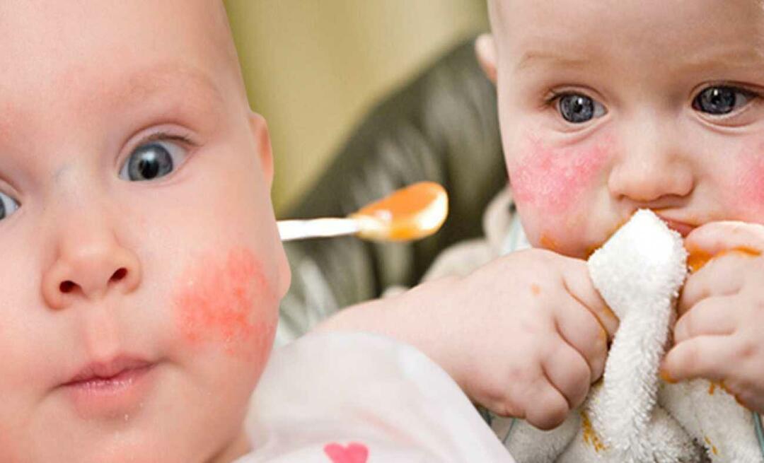 Что должен есть ребенок с аллергией? Каковы альтернативные продукты для детей с аллергией?