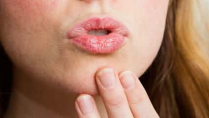 Как ухаживать за губами в домашних условиях? Легкий уход за сухими губами за 4 шага