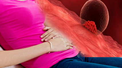 Что такое имплантационное кровотечение при беременности? Как отличить имплантационное кровотечение от менструального кровотечения